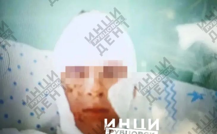 Пострадавший ребенок